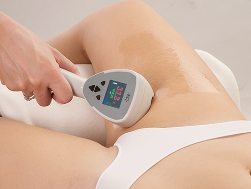 BTL_Exilis
