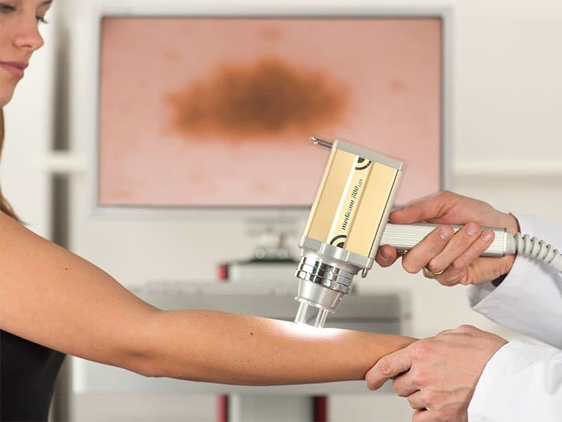 dermatoscopia_destaque dermatoscopia